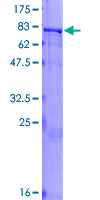 ZNF155 Protein - 12.5% SDS-PAGE of human ZNF155 stained with Coomassie Blue