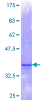 ZNF157 Protein - 12.5% SDS-PAGE Stained with Coomassie Blue.