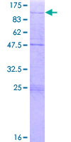 ZNF16 Protein - 12.5% SDS-PAGE of human ZNF16 stained with Coomassie Blue