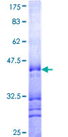 ZNF16 Protein - 12.5% SDS-PAGE Stained with Coomassie Blue.
