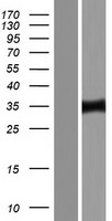 ZNF167 Protein - Western validation with an anti-DDK antibody * L: Control HEK293 lysate R: Over-expression lysate