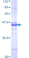 ZNF167 Protein - 12.5% SDS-PAGE Stained with Coomassie Blue.