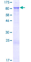 ZNF169 Protein - 12.5% SDS-PAGE of human ZNF169 stained with Coomassie Blue