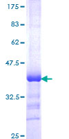 ZNF169 Protein - 12.5% SDS-PAGE Stained with Coomassie Blue.