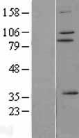ZNF175 Protein - Western validation with an anti-DDK antibody * L: Control HEK293 lysate R: Over-expression lysate