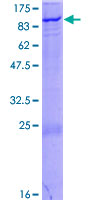 ZNF175 Protein - 12.5% SDS-PAGE of human ZNF175 stained with Coomassie Blue