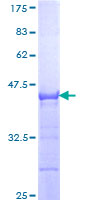 ZNF175 Protein - 12.5% SDS-PAGE Stained with Coomassie Blue.