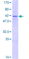 ZNF177 / PIGX Protein - 12.5% SDS-PAGE of human ZNF177 stained with Coomassie Blue