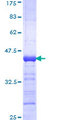ZNF18 Protein - 12.5% SDS-PAGE Stained with Coomassie Blue.