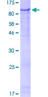 ZNF180 Protein - 12.5% SDS-PAGE of human ZNF180 stained with Coomassie Blue