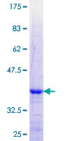 ZNF180 Protein - 12.5% SDS-PAGE Stained with Coomassie Blue.