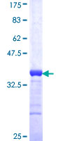 ZNF181 Protein - 12.5% SDS-PAGE Stained with Coomassie Blue.