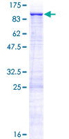 ZNF182 / ZNF21 Protein - 12.5% SDS-PAGE of human ZNF182 stained with Coomassie Blue
