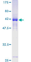 ZNF187 Protein - 12.5% SDS-PAGE of human ZNF187 stained with Coomassie Blue