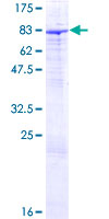 ZNF189 Protein - 12.5% SDS-PAGE of human ZNF189 stained with Coomassie Blue
