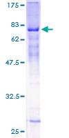 ZNF19 Protein - 12.5% SDS-PAGE of human ZNF19 stained with Coomassie Blue