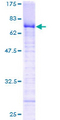 ZNF191 / ZNF24 Protein - 12.5% SDS-PAGE of human ZNF24 stained with Coomassie Blue