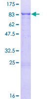ZNF192 Protein - 12.5% SDS-PAGE of human ZNF192 stained with Coomassie Blue