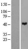 ZNF193 Protein - Western validation with an anti-DDK antibody * L: Control HEK293 lysate R: Over-expression lysate