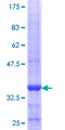 ZNF193 Protein - 12.5% SDS-PAGE Stained with Coomassie Blue.