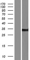ZNF197 Protein - Western validation with an anti-DDK antibody * L: Control HEK293 lysate R: Over-expression lysate