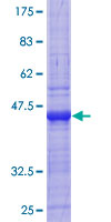 ZNF197 Protein - 12.5% SDS-PAGE Stained with Coomassie Blue.