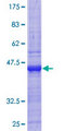 ZNF197 Protein - 12.5% SDS-PAGE Stained with Coomassie Blue.