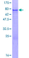 ZNF200 Protein - 12.5% SDS-PAGE of human ZNF200 stained with Coomassie Blue
