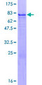 ZNF200 Protein - 12.5% SDS-PAGE of human ZNF200 stained with Coomassie Blue