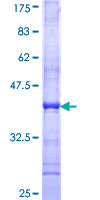 ZNF200 Protein - 12.5% SDS-PAGE Stained with Coomassie Blue.
