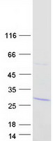 ZNF200 Protein - Purified recombinant protein ZNF200 was analyzed by SDS-PAGE gel and Coomassie Blue Staining