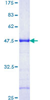 ZNF202 Protein - 12.5% SDS-PAGE Stained with Coomassie Blue.