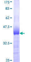 ZNF207 Protein - 12.5% SDS-PAGE Stained with Coomassie Blue.