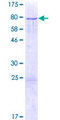 ZNF213 Protein - 12.5% SDS-PAGE of human ZNF213 stained with Coomassie Blue