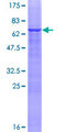 ZNF222 Protein - 12.5% SDS-PAGE of human ZNF222 stained with Coomassie Blue