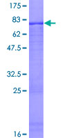 ZNF223 Protein - 12.5% SDS-PAGE of human ZNF223 stained with Coomassie Blue
