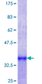 ZNF224 Protein - 12.5% SDS-PAGE Stained with Coomassie Blue