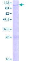 ZNF226 Protein - 12.5% SDS-PAGE of human ZNF226 stained with Coomassie Blue