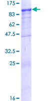 ZNF23 Protein - 12.5% SDS-PAGE of human ZNF23 stained with Coomassie Blue