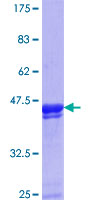 ZNF23 Protein - 12.5% SDS-PAGE Stained with Coomassie Blue.
