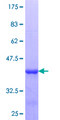ZNF232 Protein - 12.5% SDS-PAGE Stained with Coomassie Blue