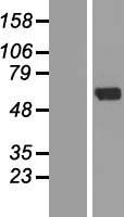 ZNF238 Protein - Western validation with an anti-DDK antibody * L: Control HEK293 lysate R: Over-expression lysate