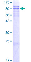 ZNF238 Protein - 12.5% SDS-PAGE of human ZNF238 stained with Coomassie Blue