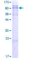 ZNF238 Protein - 12.5% SDS-PAGE of human ZNF238 stained with Coomassie Blue
