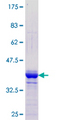 ZNF238 Protein - 12.5% SDS-PAGE Stained with Coomassie Blue.