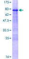 ZNF239 Protein - 12.5% SDS-PAGE of human ZNF239 stained with Coomassie Blue