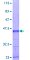 ZNF239 Protein - 12.5% SDS-PAGE Stained with Coomassie Blue.