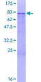 ZNF253 Protein - 12.5% SDS-PAGE of human ZNF253 stained with Coomassie Blue