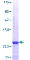 ZNF253 Protein - 12.5% SDS-PAGE Stained with Coomassie Blue.
