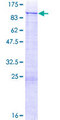 ZNF254 Protein - 12.5% SDS-PAGE of human ZNF254 stained with Coomassie Blue